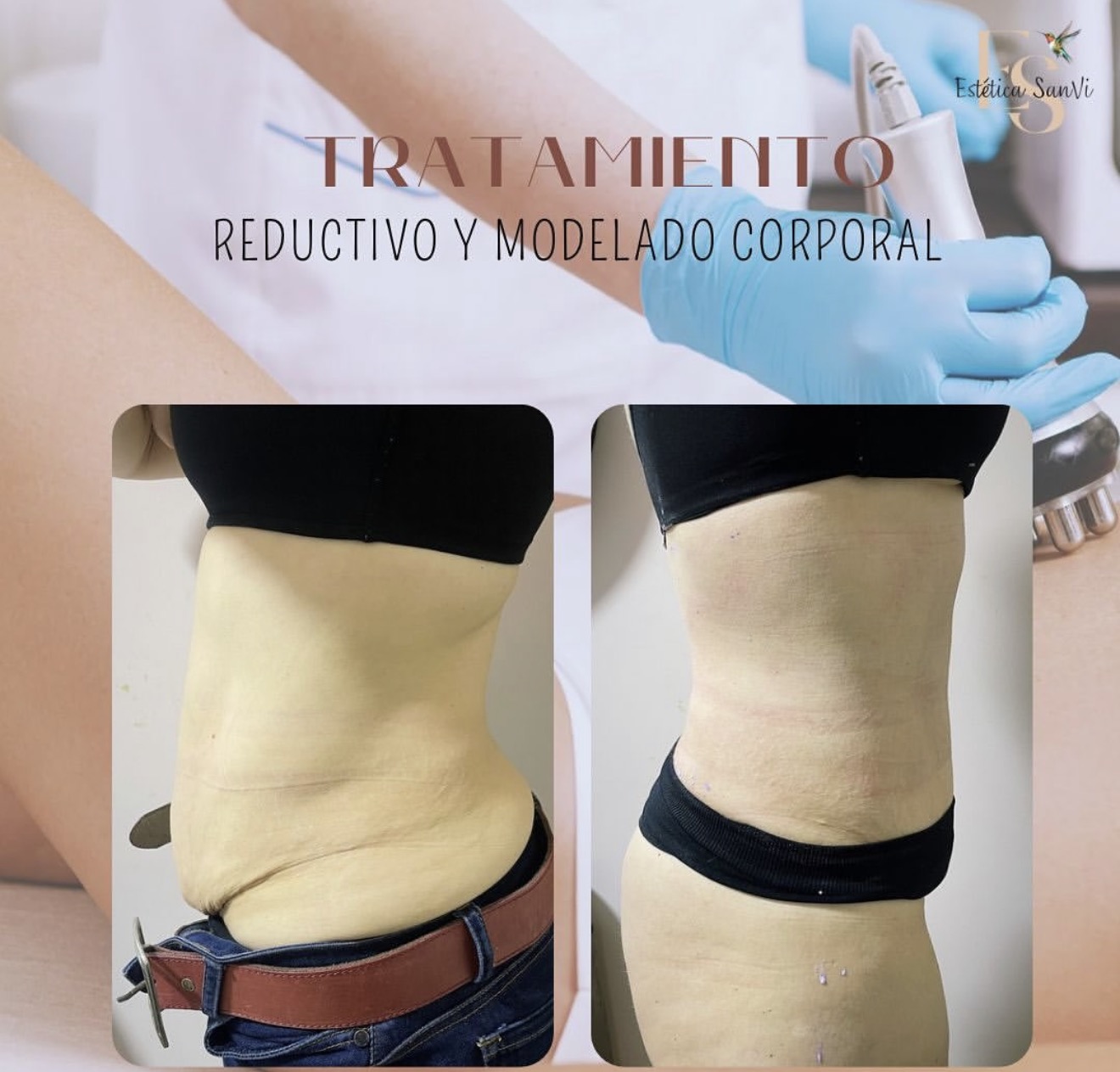 Después de lifting de pestañas y tinte en Estética SanVi, San Vicente