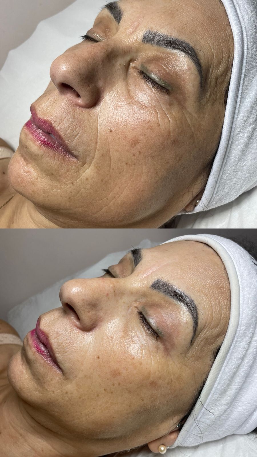 Antes y después de micropigmentación de cejas en Estética SanVi, San Vicente de Tagua Tagua