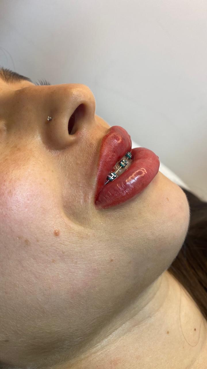 Después de micropigmentación de labios en Estética SanVi, San Vicente